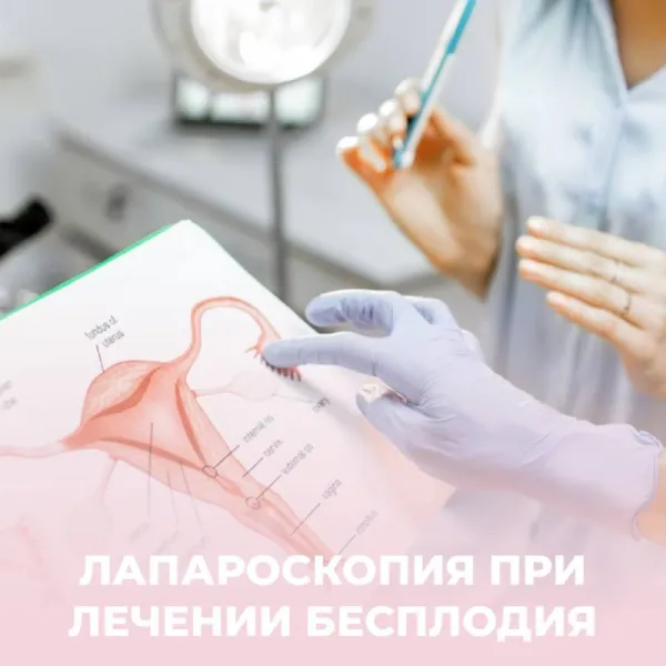 Лапароскопия в гинекологии: диагностика и лечение